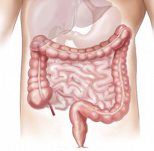 Vitamin E Deficiency-What causes it? How do you know if you have it? Find out what to do about it here. www.thehealthnutmama.com